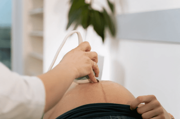 Begini Cara Menghitung Usia Kehamilan, Ibu Hamil USG
